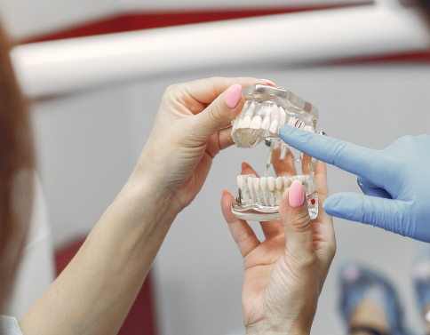 Особенности и варианты протезирования передних зубов 