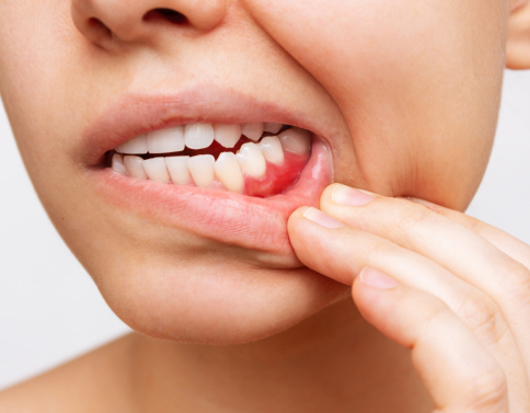 Ноет десна после лечения зуба: что делать, какие препараты помогут