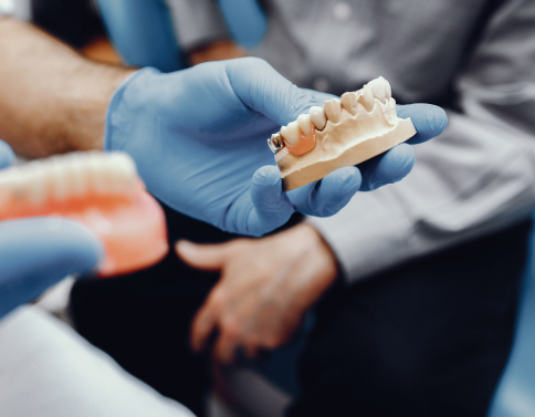 Особенности установки зубных имплантантов (имплантов) при&nbspразличных показаниях