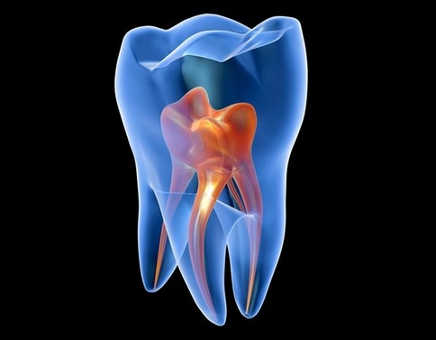Лечение воспаления зубного нерва